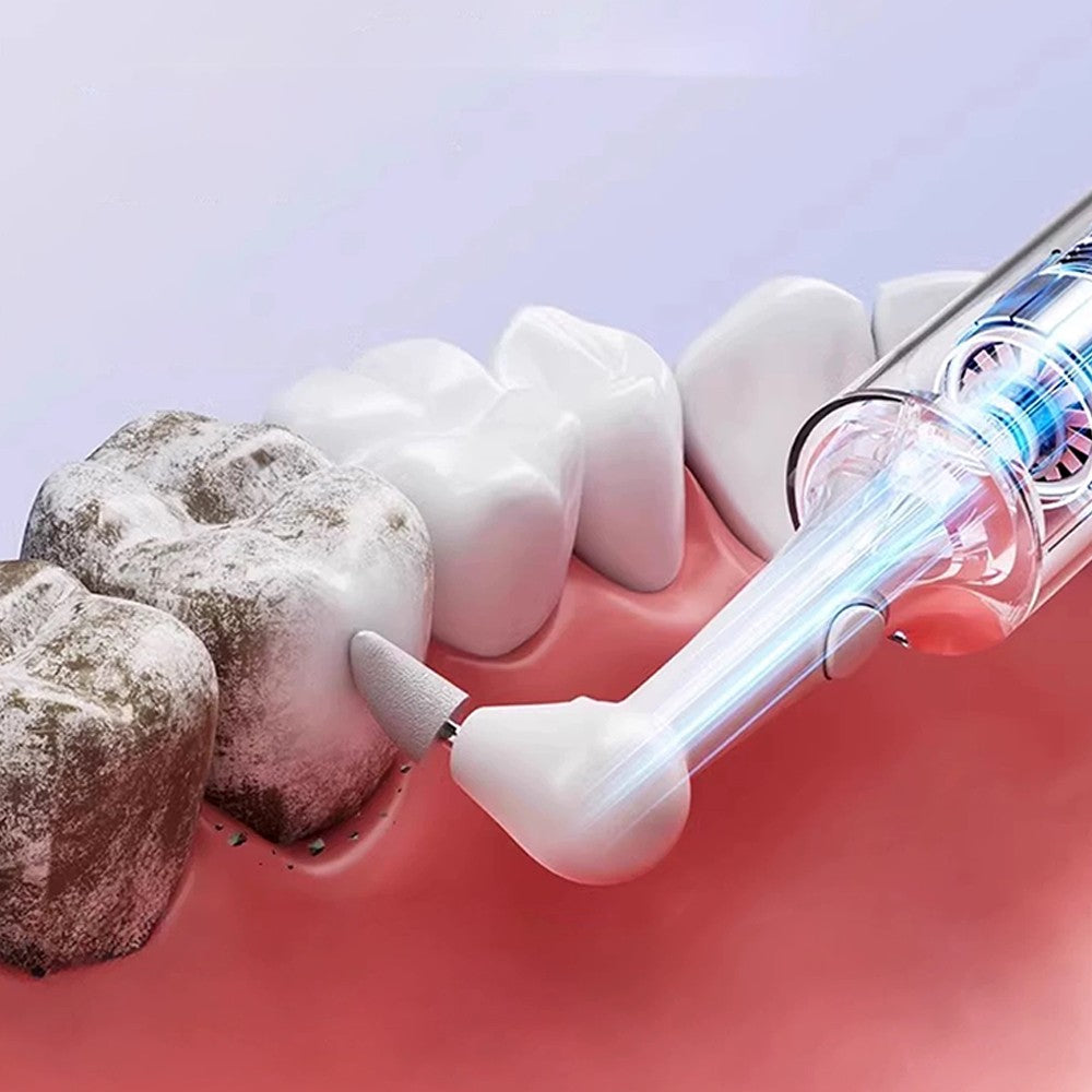 Next-Generation Ultrasonic Teeth Cleaner